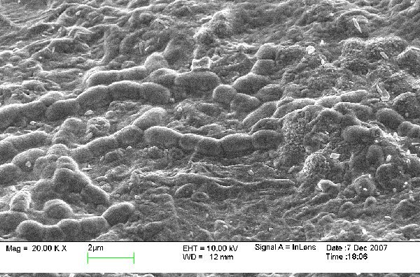 chip tuning fig7 bacterias3 Biomídia MBBR